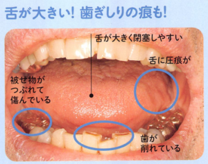 舌が大きい