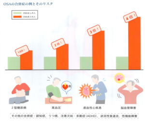 OSAの合併症とリスク